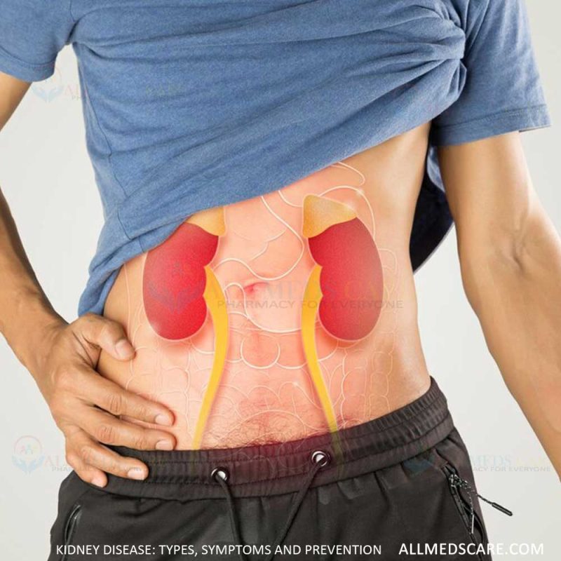 kidney disease full details