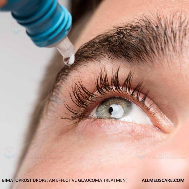 bimatoprost drops glaucoma treatment